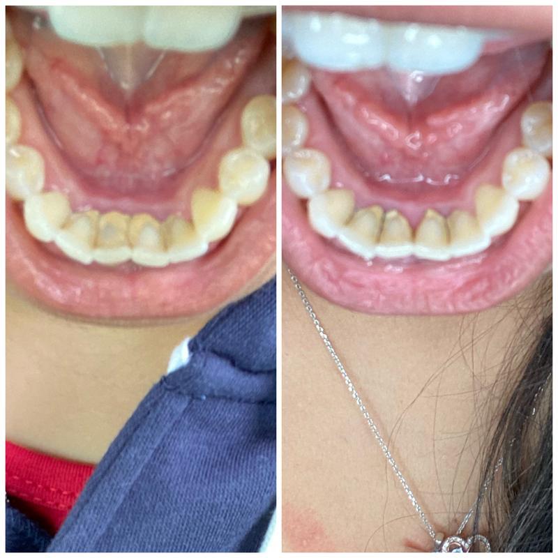 WELLFITORA™️ Guru Nanda Coconut Oil Pulling with Essential Oils