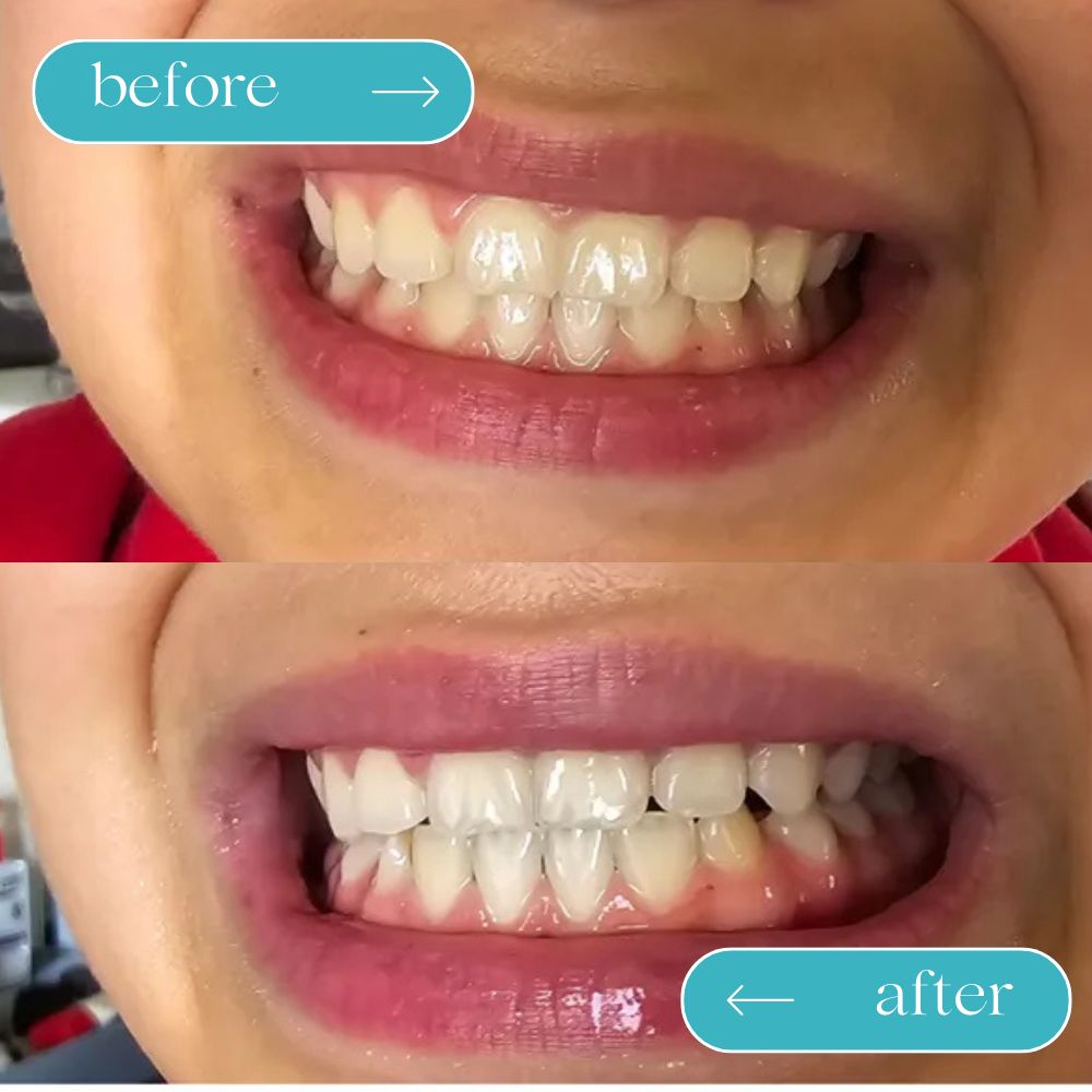 WELLFITORA™️ Guru Nanda Coconut Oil Pulling with Essential Oils