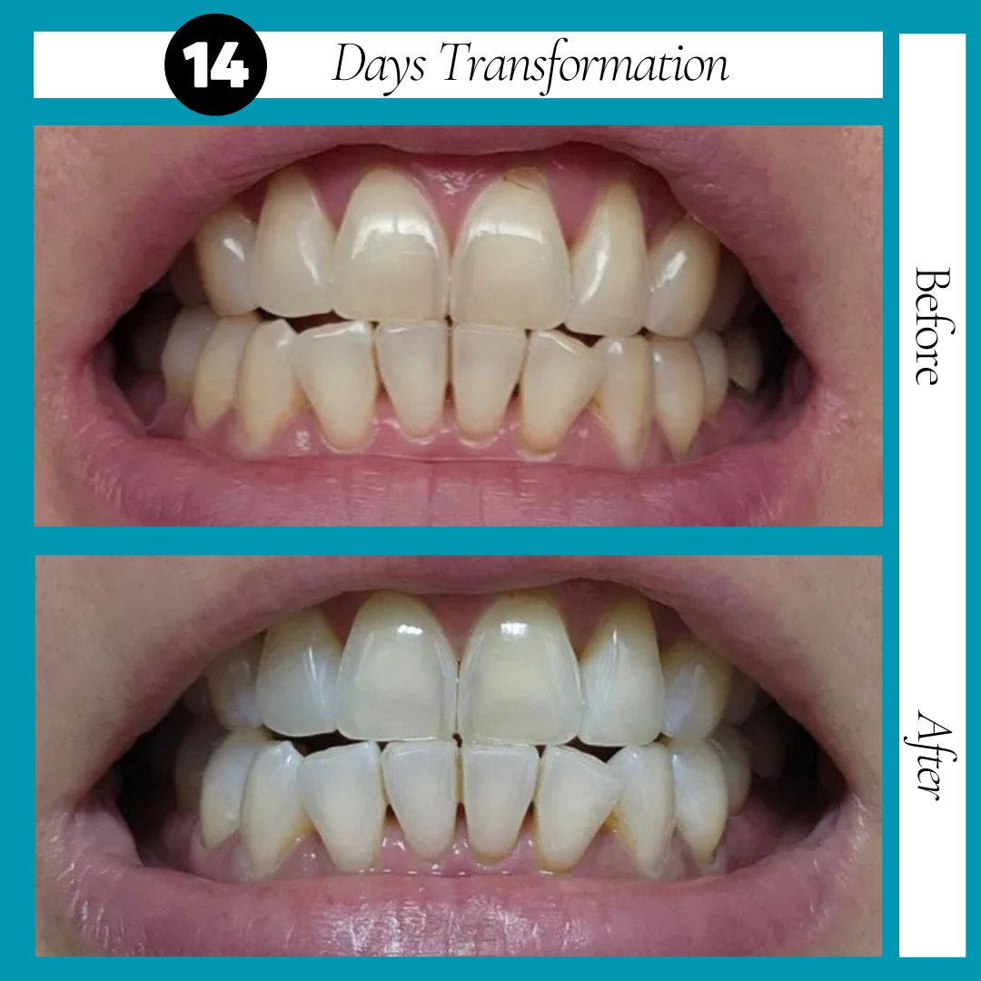 WELLFITORA™️ Guru Nanda Coconut Oil Pulling with Essential Oils