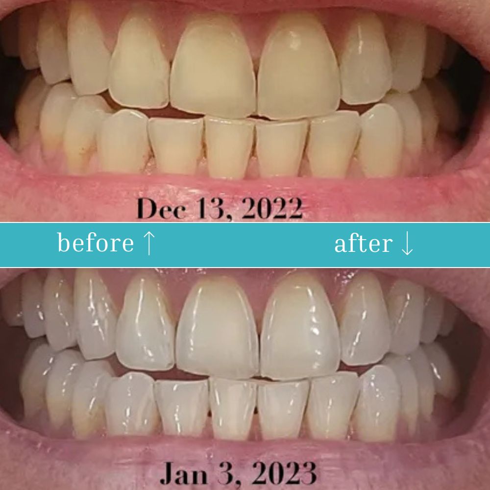 WELLFITORA™️ Guru Nanda Coconut Oil Pulling with Essential Oils