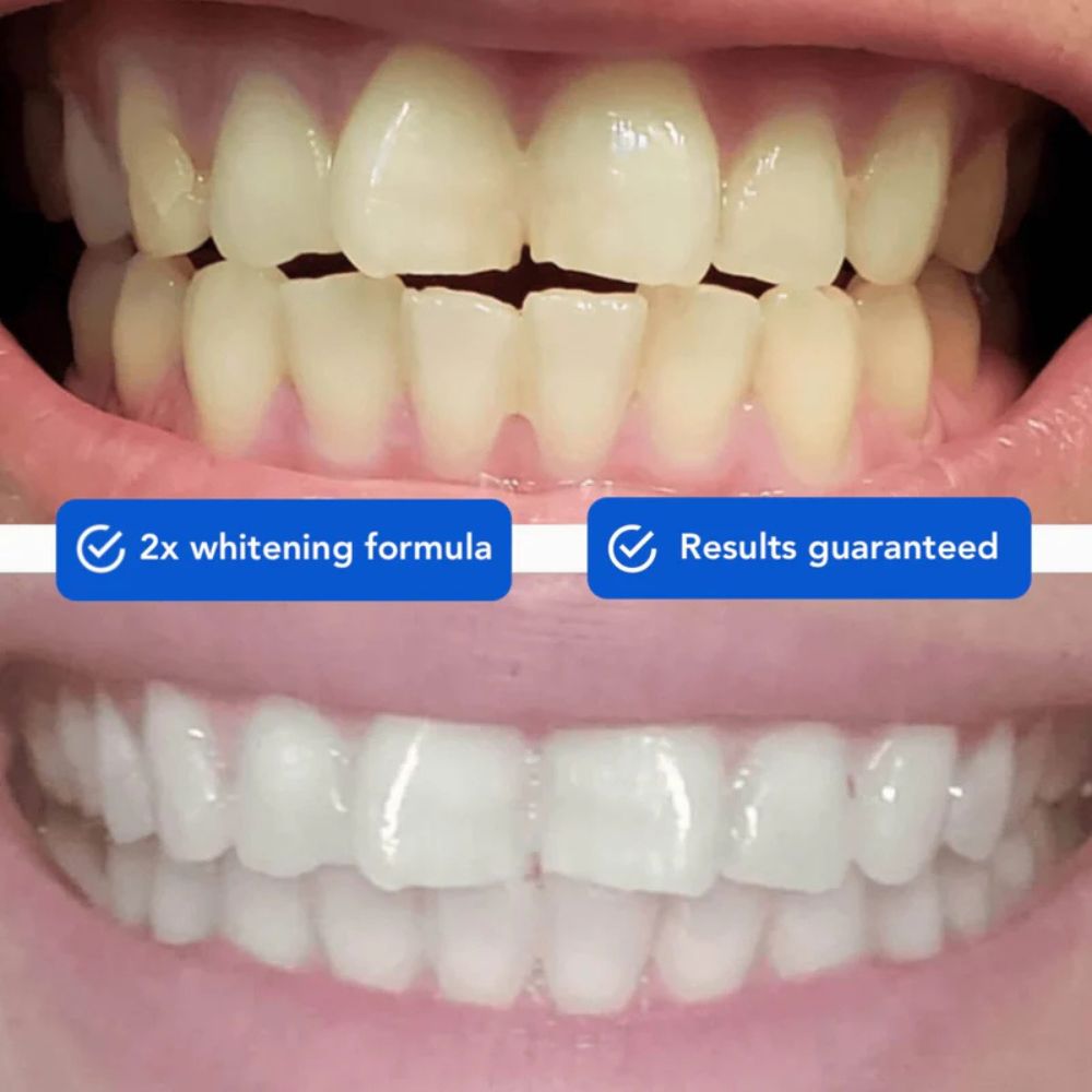 WELLFITORA™️ Guru Nanda Coconut Oil Pulling with Essential Oils